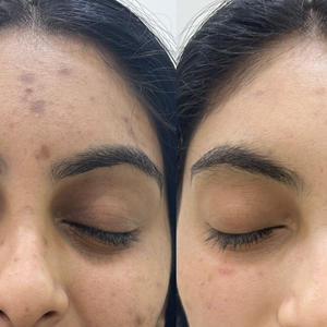 Sérum éclat pour éliminer les taches brunes